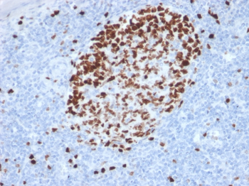 MKI67 Antibody