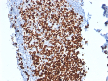 MKI67 Antibody