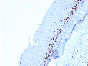 MKI67 Antibody