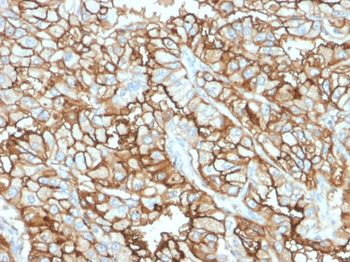 MME Antibody