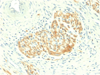 NCAM1 Antibody