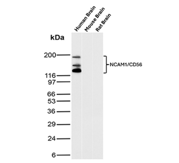 NCAM1 Antibody