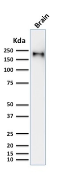 NEFH Antibody