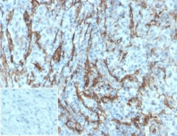 NGFR Antibody