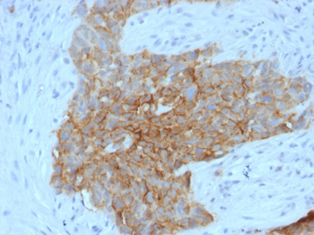 SLC2A1 Antibody