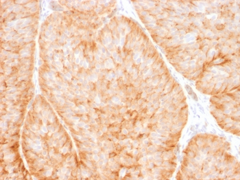 SLC2A1 Antibody