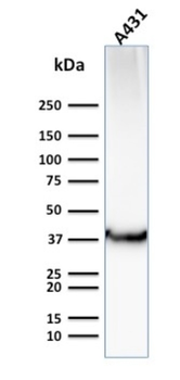SLC2A1 Antibody