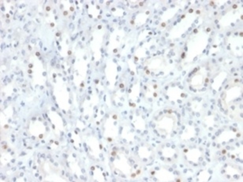 STAT6 Antibody