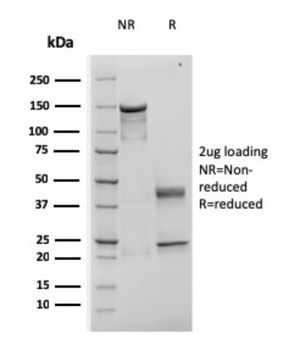 TIMP1 Antibody