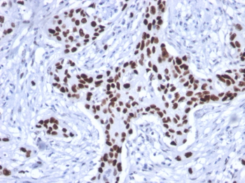 TP53 Antibody