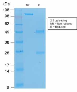 TP53 Antibody