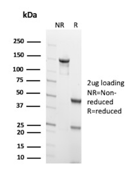 TP53 Antibody
