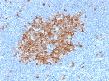 TYMS Antibody