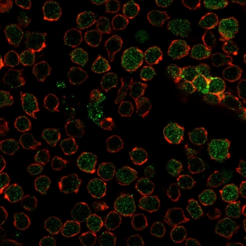 TYMS Antibody