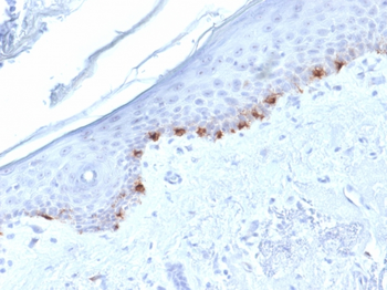 TYRP1 Antibody