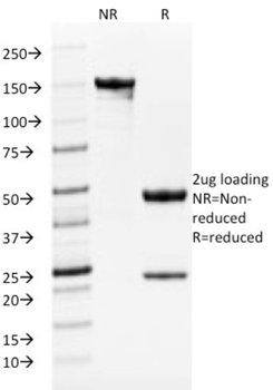 TYRP1 Antibody