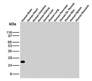 UCHL1 Antibody