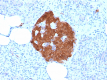 UCHL1 Antibody