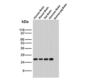 UCHL1 Antibody