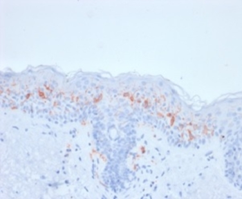 CD1A Antibody