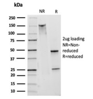 CD1A Antibody