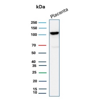 CDH1 Antibody