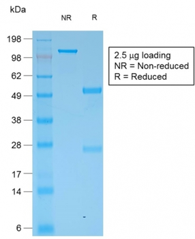 KRT6A Antibody