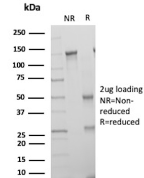 KRT6A Antibody