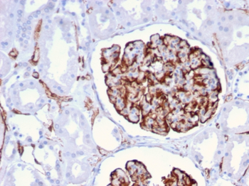 NES Antibody
