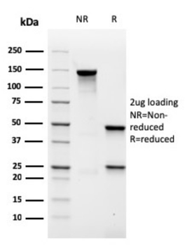 MALT1 Antibody