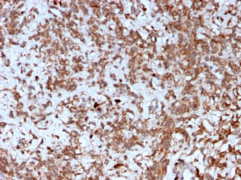 CTSK Antibody