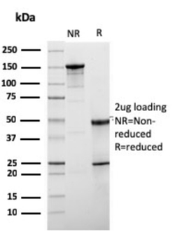 ERBB2 Antibody