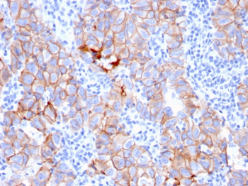 ERBB2 Antibody