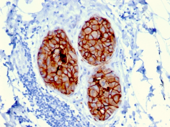 ERBB2 Antibody