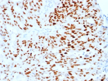 ESR1 Antibody