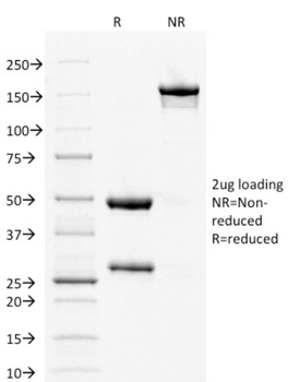 ESR1 Antibody