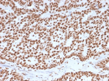 ESR1 Antibody