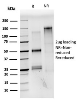 ESR1 Antibody