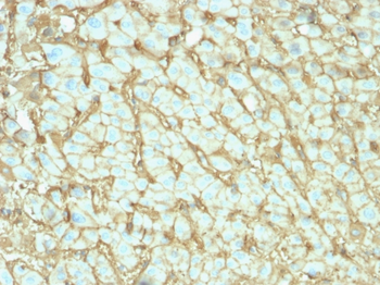 ALB Antibody