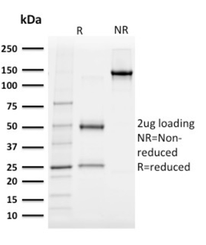 ALB Antibody