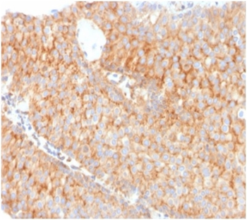 SERBP1 Antibody