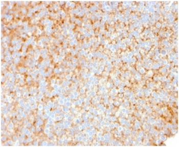 SERBP1 Antibody