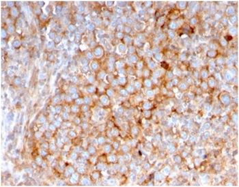 SERBP1 Antibody