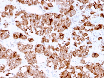 GH1 Antibody
