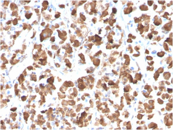 GH1 Antibody