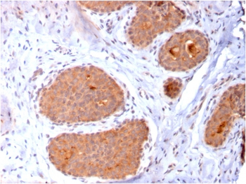 HSPD1 Antibody