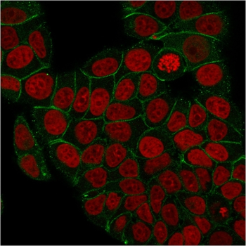 JUP Antibody
