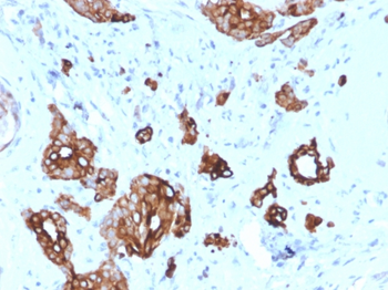 KRT7 Antibody