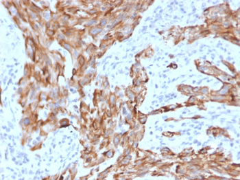 KRT7 Antibody