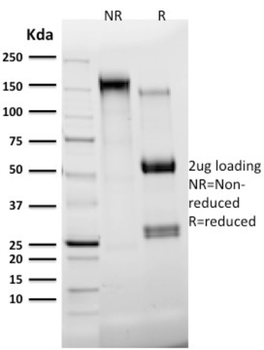 KRT7 Antibody